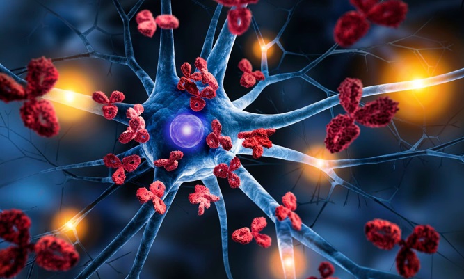 Aceite de Cannabis para el Tratamiento de la Esclerosis Múltiple